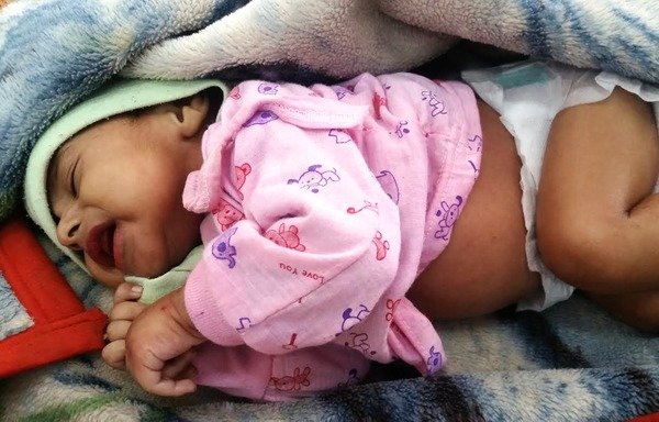 A infant girl infected with cholera rests on a blanket at al-Sabeen Hospital in Sanaa. [Photo courtesy of Abdullatif Abdullah]