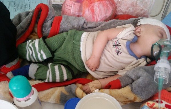 A Yemeni boy suspected of being infected with cholera receives treatment at Sabeen Maternity Hospital in Sanaa. [Faisal Darem/Al-Mashareq]