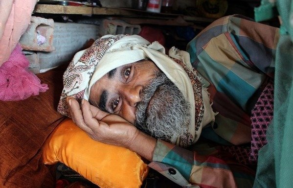 رجل يمني نزح هربا من المعارك بين قوات التحالف والحوثيين في منطقة هراد يستريح في الظل في مخيم للنازحين شمال مديرية عبس في محافظة حجة، في 16 كانون الثاني/يناير. [مصور مستقل/وكالة الصحافة الفرنسية]