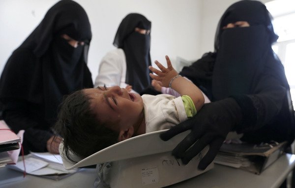 A Yemeni nurse weighs a child at a medical centre on the outskirts of Sanaa, on January 6th. [Mohammed Huwais/AFP]