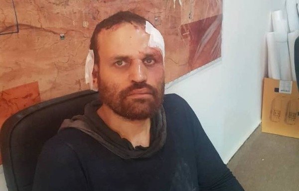 Hesham Ashmawi, the Egyptian leader of al-Qaeda-linked al-Mourabitoun, is seen here after Libyan forces arrested him in Derna.  [Photo courtesy of the official spokesman of the Libyan Armed Forces]