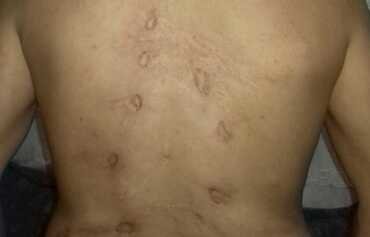 Syrian returnees arrested, tortured by regime