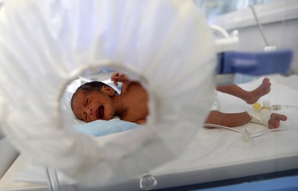 A malnourished newborn baby lies in an incubator at al-Sabeen hospital in the Yemeni capital Sanaa on November 23rd. The Yemeni government on December 18th accused the Houthis of restricting the work of UN and other humanitarian aid organisations. [Mohammed Huwais/AFP]