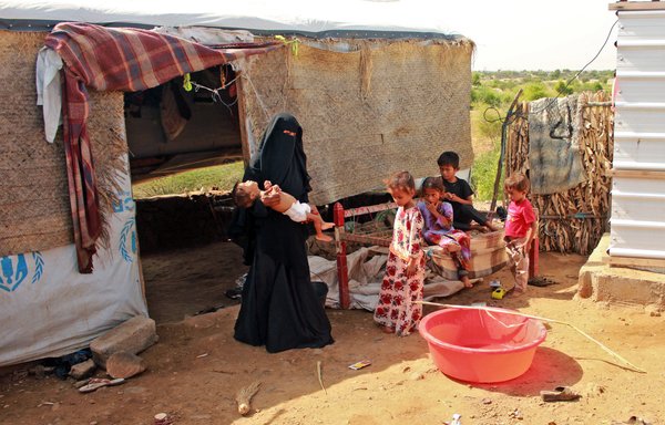 Hashem Mahmoud Atin, a ten-month-old displaced Yemeni child suffering from acute malnutrition and who is unable to reach a hospital for treatment, is held by his mother at a camp in Abs in northern Yemen's Hajjah province on September 3rd in Yemen's displaced camps. [Essa Ahmed/AFP]