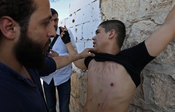 A Syrian prisoner released from a regime jail shows his wounds to opposition fighters upon his arrival at the al-Eis crossing point south of Aleppo on July 19, 2018. [Omar Haj Kadour/AFP]