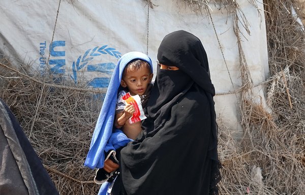 A Yemeni woman displaced by conflict holds her 2-year-old son, who weighs only five kilogrammes, outside a shelter in al-Hodeidah province on February 15. [Khaled Ziad/AFP]