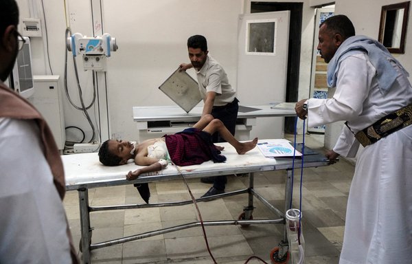 A wounded Yemeni child receives medical treatment following an attack attributed to the Houthis near a playground in Marib on April 3. [AFP]