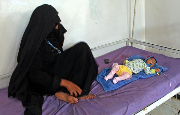 طفل يعاني من سوء التغذية، يتلقى العلاج في مركز للرعاية الصحية بمحافظة حجة اليمنية في 21 آذار/مارس. [عيسى أحمد/وكالة الصحافة الفرنسية]