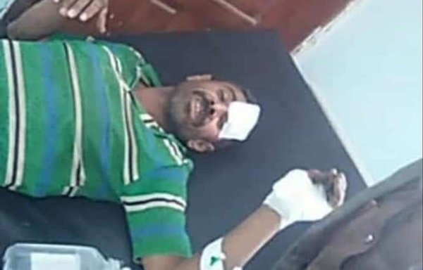 احمد بن حمد الشعبی روز ۱۹ مهر بر اثر انفجار یک مین کاشته شده توسط حوثی ها زیر خودرویش در منطقه خب والشعاف مجروح شد. [سوابق مین های یمن]