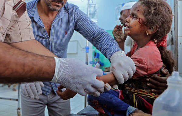 Yemeni medics at Marib Hospital treat a girl who was injured in a missile strike on a residential area in the city on October 3. [AFP]