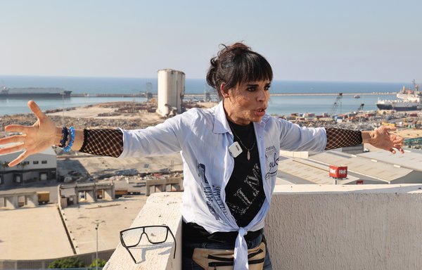 Amanda Cherri, a survivor of the August 4, 2020, Beirut port blast, lost sight in one eye and no longer can use her left hand. [Anwar Amro/AFP]
